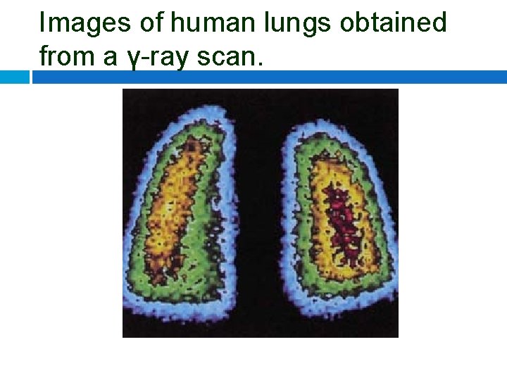 Images of human lungs obtained from a γ-ray scan. 