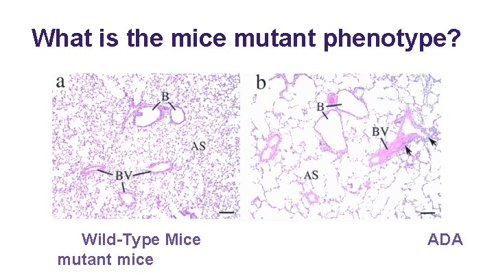 What is the mice mutant phenotype? Wild-Type Mice mutant mice ADA 