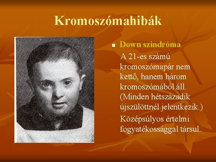 Kromoszómahibák n Down szindróma A 21 -es számú kromoszómapár nem kettő, hanem három kromoszómából