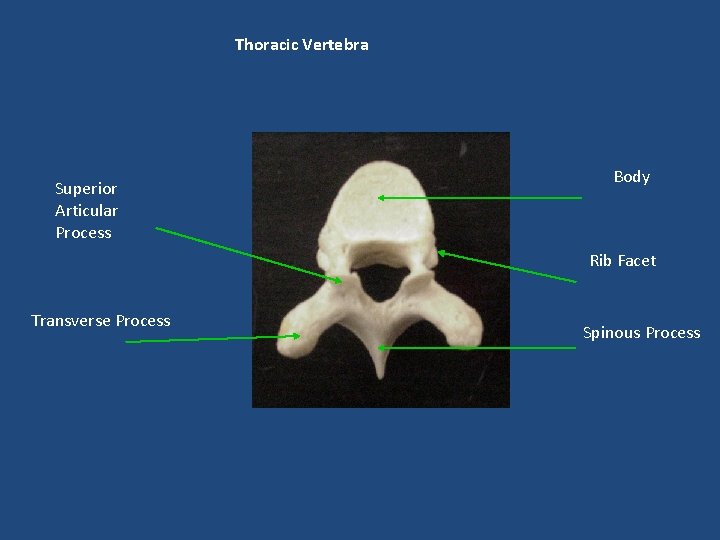 Thoracic Vertebra Superior Articular Process Body Rib Facet Transverse Process Spinous Process 