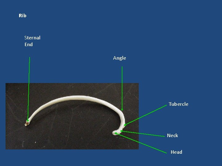 Rib Sternal End Angle Tubercle Neck Head 