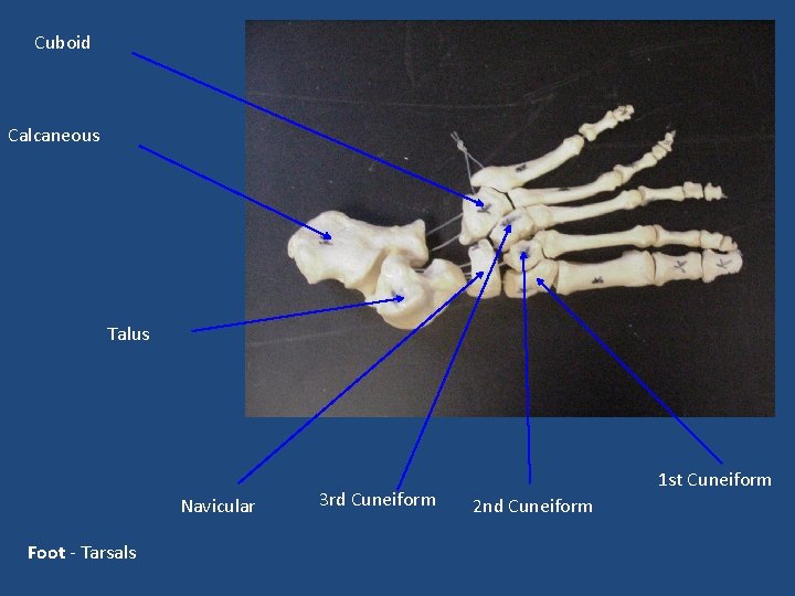 Cuboid Calcaneous Talus Navicular Foot - Tarsals 3 rd Cuneiform 1 st Cuneiform 2