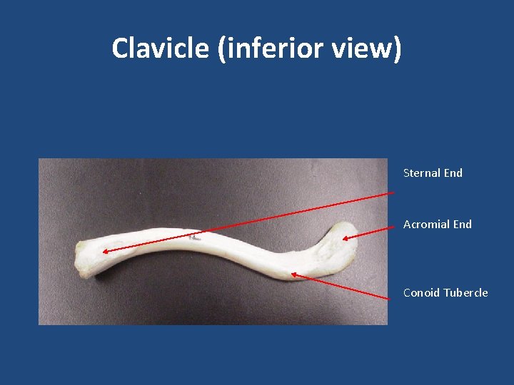 Clavicle (inferior view) Sternal End Acromial End Conoid Tubercle 