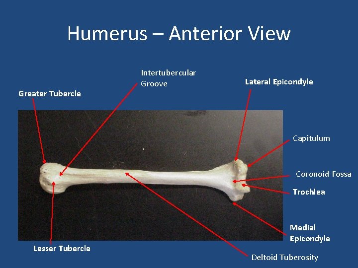 Humerus – Anterior View Greater Tubercle Intertubercular Groove Lateral Epicondyle Capitulum Coronoid Fossa Trochlea