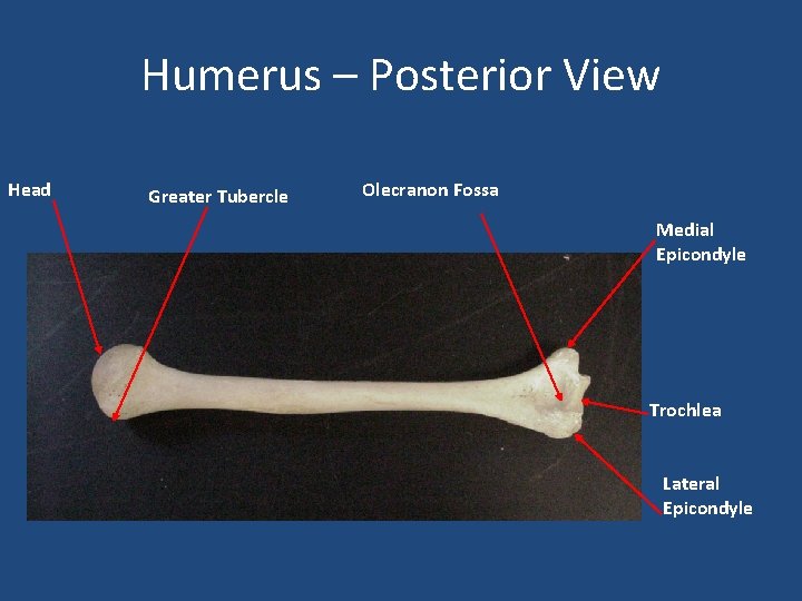Humerus – Posterior View Head Greater Tubercle Olecranon Fossa Medial Epicondyle Trochlea Lateral Epicondyle