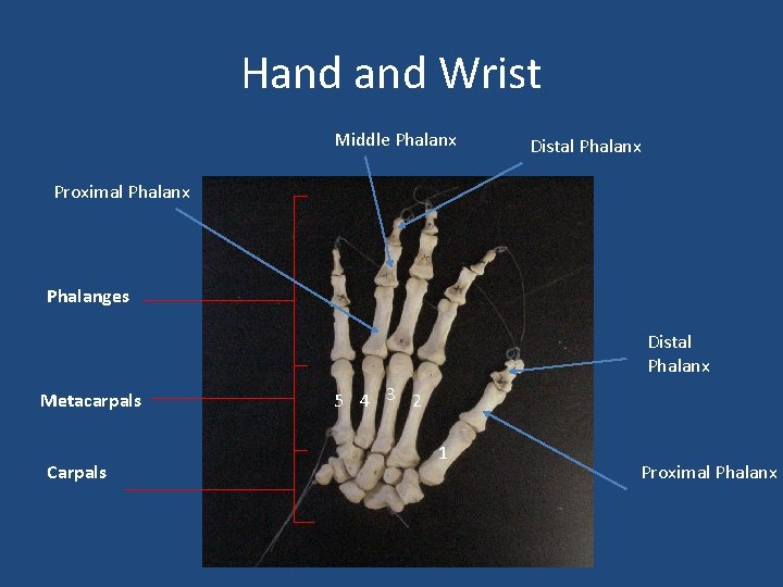 Hand Wrist Middle Phalanx Distal Phalanx Proximal Phalanx Phalanges Distal Phalanx Metacarpals Carpals 5