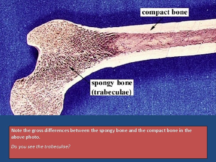 Note the gross differences between the spongy bone and the compact bone in the