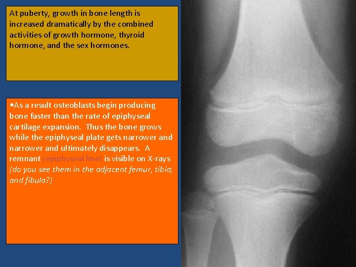 At puberty, growth in bone length is increased dramatically by the combined activities of