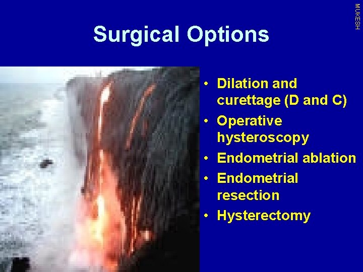 MUKESH Surgical Options • Dilation and curettage (D and C) • Operative hysteroscopy •