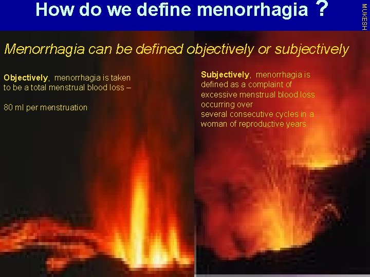 ? Menorrhagia can be defined objectively or subjectively Objectively, menorrhagia is taken to be