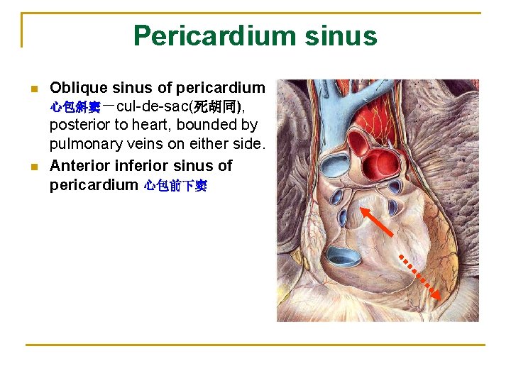 Pericardium sinus n n Oblique sinus of pericardium 心包斜窦－cul-de-sac(死胡同), posterior to heart, bounded by