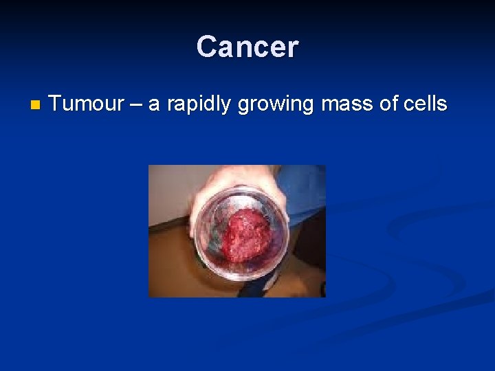 Cancer n Tumour – a rapidly growing mass of cells 