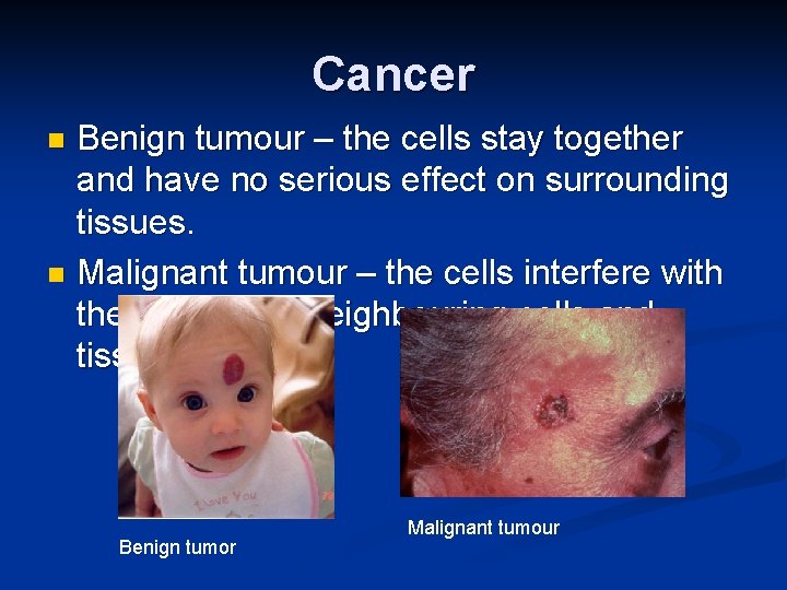 Cancer Benign tumour – the cells stay together and have no serious effect on
