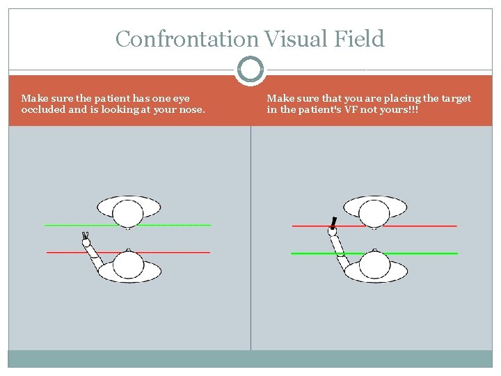 Confrontation Visual Field Make sure the patient has one eye occluded and is looking