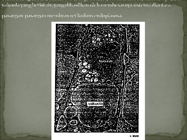 Pada mikrograf elektron dari irisan tipis suatu sel tumbuhan akan menunjukkan vakuola yang berisi