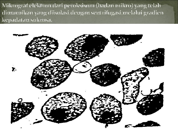 Mikrograf elektron dari peroksisom (badan mikro) yang telah dimurnikan yang diisolasi dengan sentrifugasi melalui