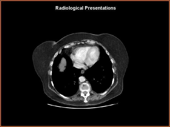 Radiological Presentations 