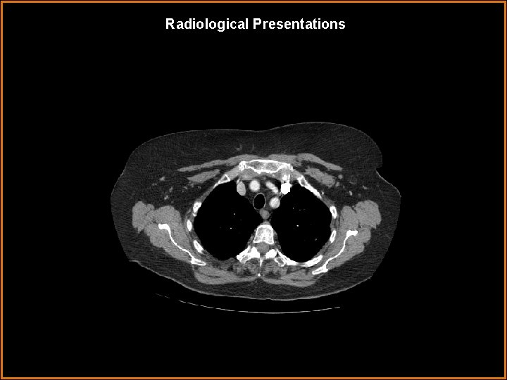 Radiological Presentations 