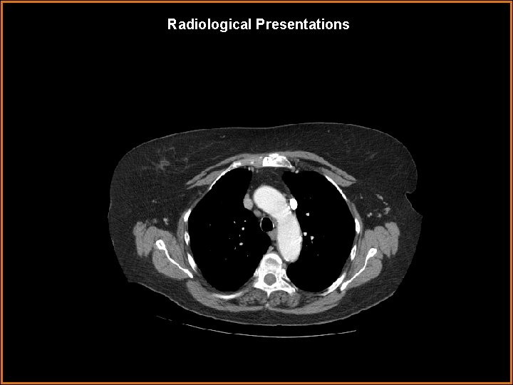 Radiological Presentations 