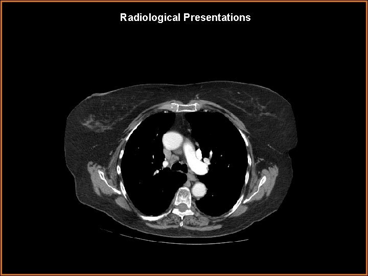 Radiological Presentations 