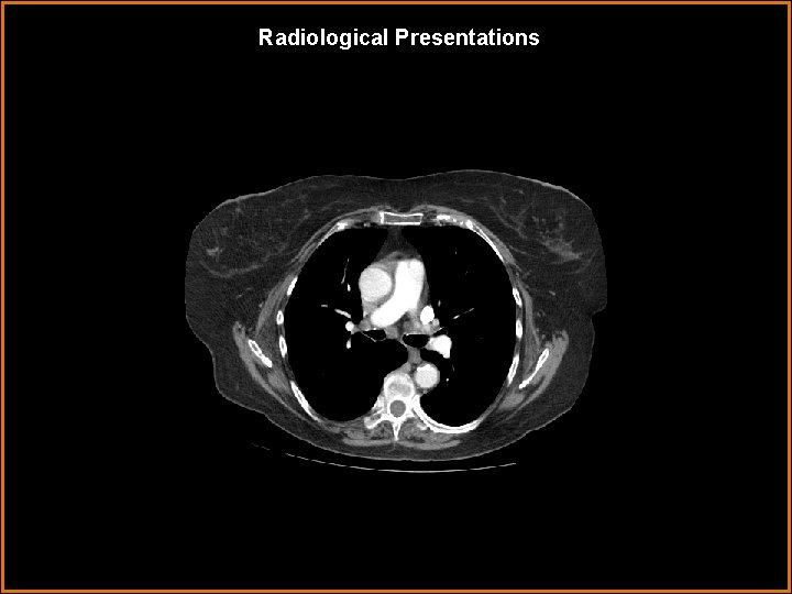 Radiological Presentations 