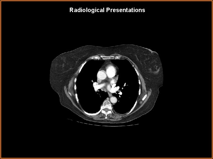 Radiological Presentations 