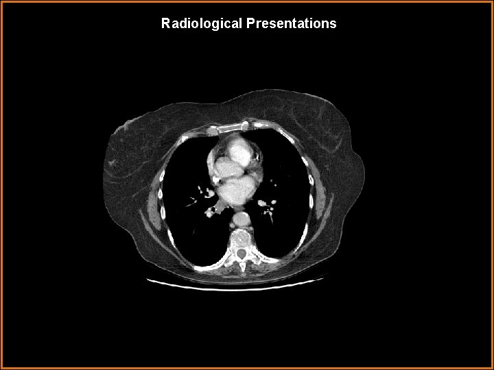 Radiological Presentations 