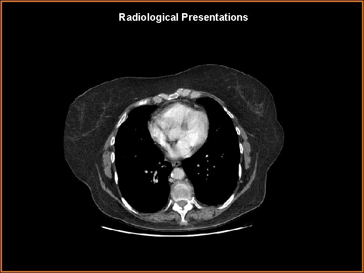 Radiological Presentations 