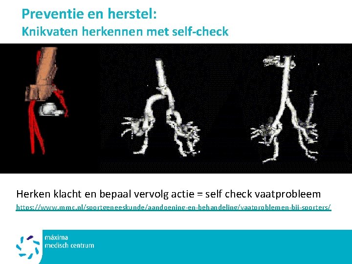 Preventie en herstel: Knikvaten herkennen met self-check Herken klacht en bepaal vervolg actie =