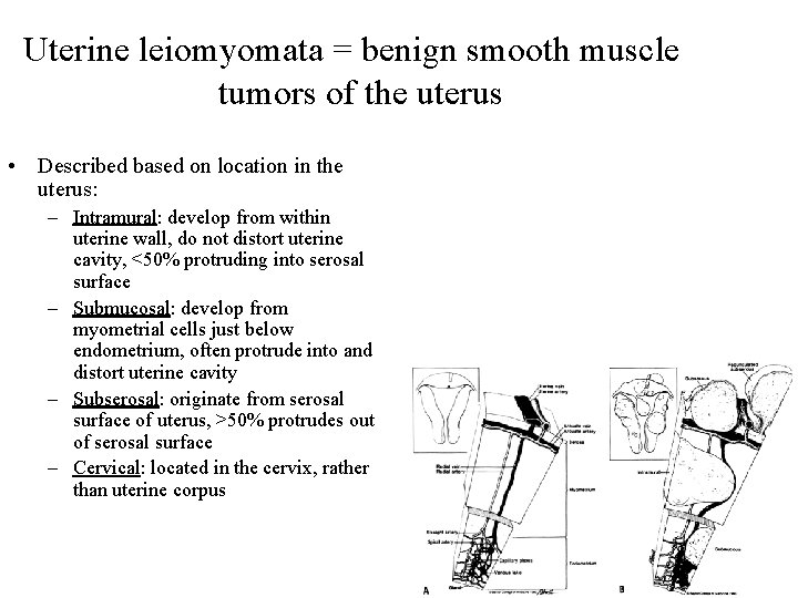 Uterine leiomyomata = benign smooth muscle tumors of the uterus • Described based on