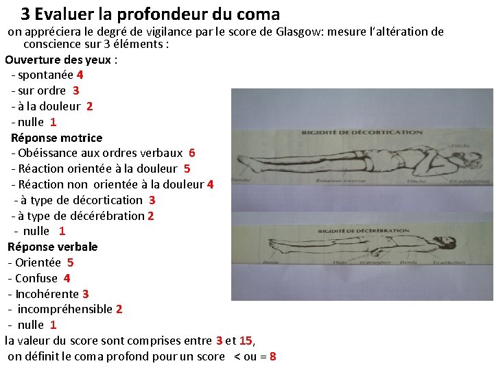 3 Evaluer la profondeur du coma on appréciera le degré de vigilance par le