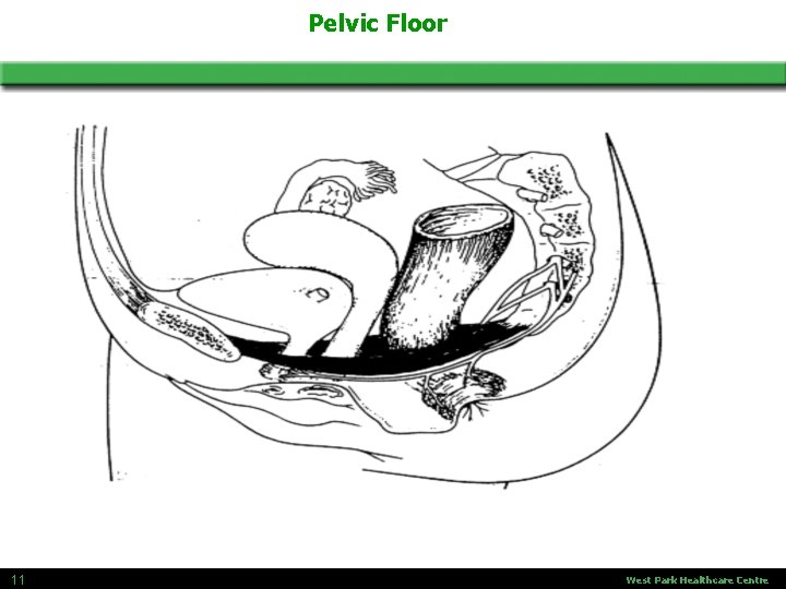 Pelvic Floor 11 West Park Healthcare Centre 