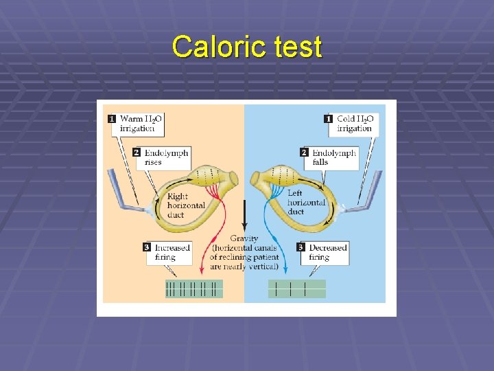 Caloric test 