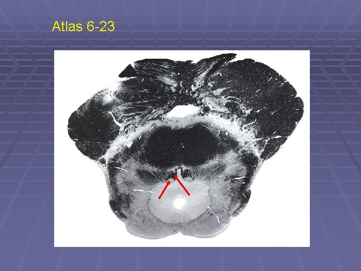 Atlas 6 -23 
