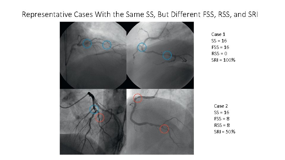 Representative Cases With the Same SS, But Different FSS, RSS, and SRI Case 1