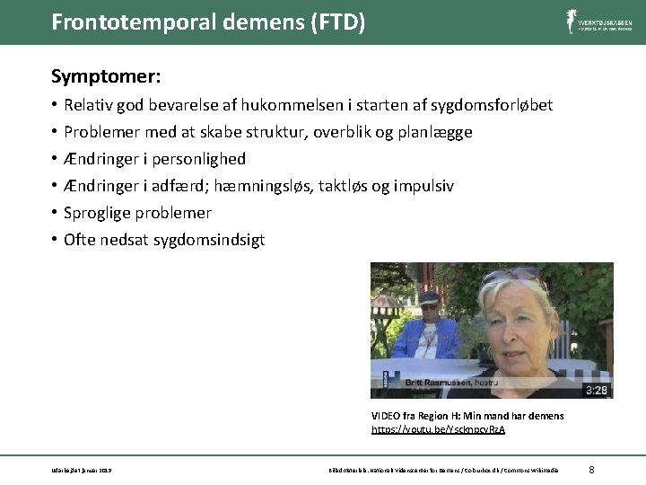 Frontotemporal demens (FTD) Symptomer: • • • Relativ god bevarelse af hukommelsen i starten