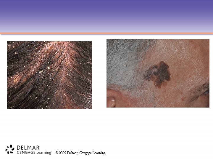 © 2009 Delmar, Cengage Learning 