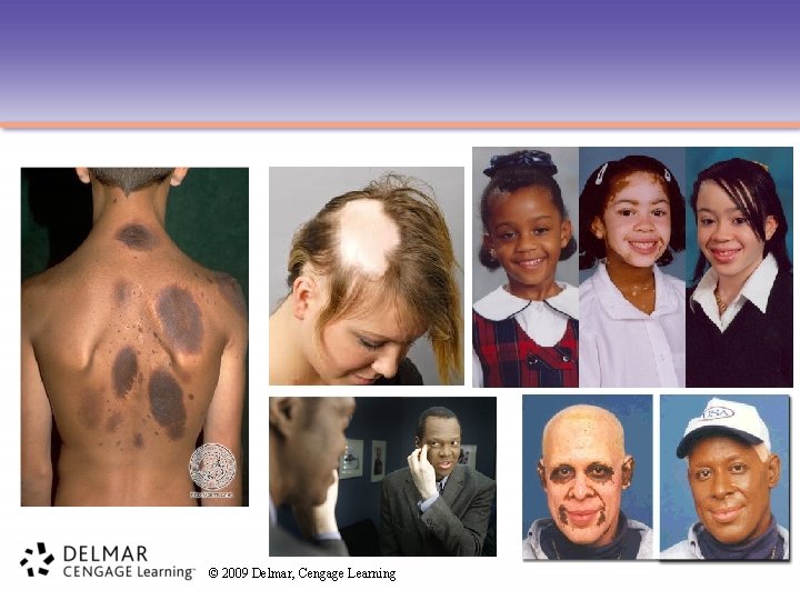 © 2009 Delmar, Cengage Learning 