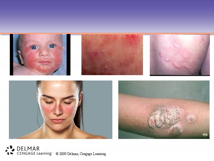 © 2009 Delmar, Cengage Learning 