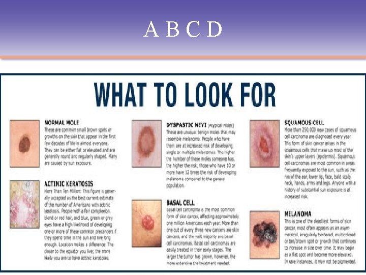 ABCD © 2009 Delmar, Cengage Learning 