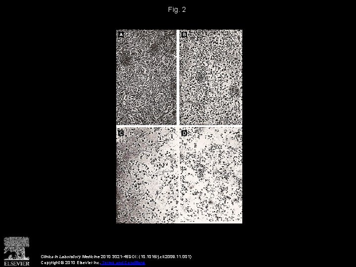 Fig. 2 Clinics in Laboratory Medicine 2010 3021 -45 DOI: (10. 1016/j. cll. 2009.