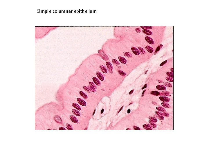 Simple columnar epithelium 