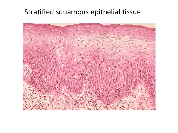 Stratified squamous epithelial tissue 