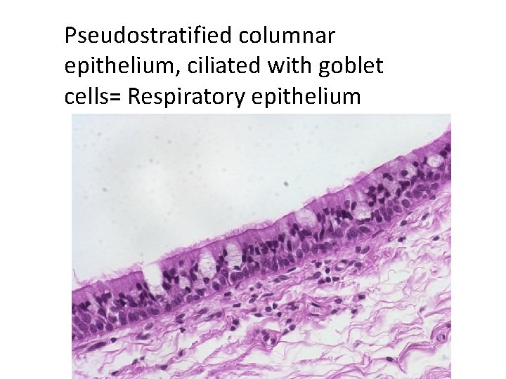 Pseudostratified columnar epithelium, ciliated with goblet cells= Respiratory epithelium 