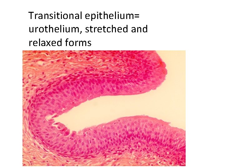 Transitional epithelium= urothelium, stretched and relaxed forms 