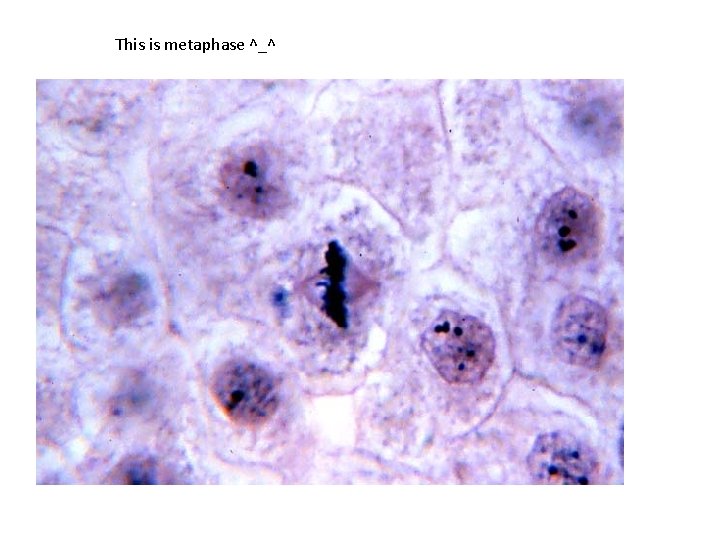 This is metaphase ^_^ 