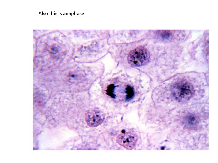 Also this is anaphase 