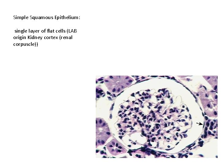 Simple Squamous Epithelium: single layer of flat cells (LAB origin Kidney cortex (renal corpuscle))
