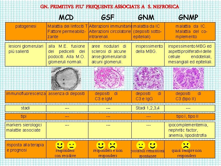 GN. PRIMITIVE PIU’ FREQUENTE ASSOCIATE A S. NEFROSICA MCD patogenesi lesioni glomerulari più salienti