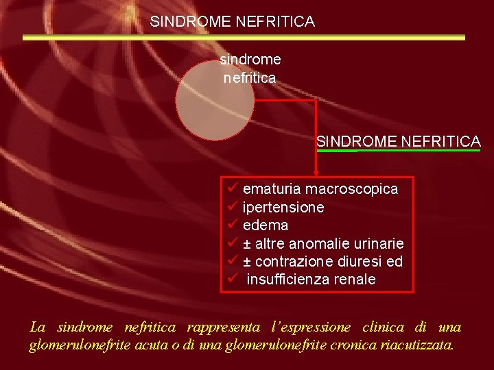 SINDROME NEFRITICA sindrome nefritica SINDROME NEFRITICA ü ematuria macroscopica ü ipertensione ü edema ü